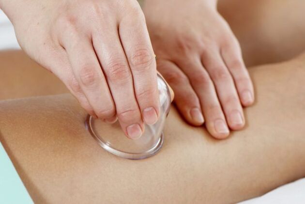 cupping massage alang sa varicose veins