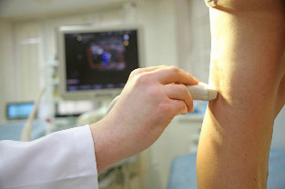Ultrasound sa mga ugat sa ubos-ubos extremities